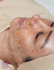 و مرکز زیبایی نشمیل آموزش تخصصی فیشال و پاک سازی پوست در گلسار رشت 14