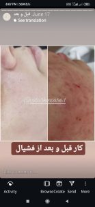 ‏‏زیبایی ‏ویدارخ ‏کراتین ‏بافت ‏مو ‏و ‏شینیون ‏در ‏بلوار ‏استقلال ‏کرج 12