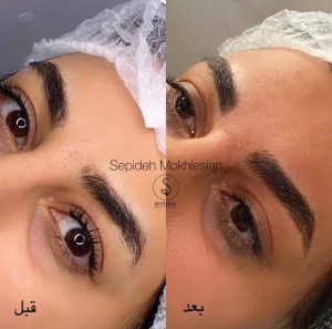 ‏مخلصیان ‏آرایش ‏دائم ‏صورت ‏فیبروز ‏میکروبلیدینگ ‏در ‏پونک ‏غرب ‏تهران 13