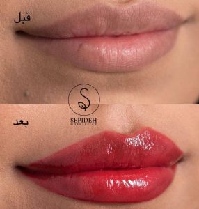 ‏مخلصیان ‏آرایش ‏دائم ‏صورت ‏فیبروز ‏میکروبلیدینگ ‏در ‏پونک ‏غرب ‏تهران 18