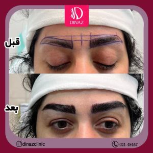 کلینیک ‏زیبایی ‏دیناز ‏خدمات ‏کاشت ‏مو ‏و ‏کاشت ‏ابرو ‏و ‏بلفاروپلاستی ‏در ‏تهران ‏سعادت ‏آباد