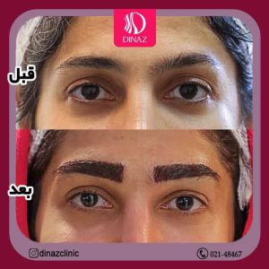 کلینیک ‏زیبایی ‏دیناز ‏خدمات ‏کاشت ‏مو ‏و ‏کاشت ‏ابرو ‏و ‏بلفاروپلاستی ‏در ‏تهران ‏سعادت ‏آباد