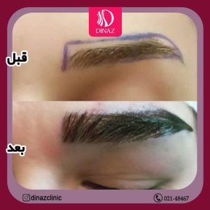 کلینیک ‏زیبایی ‏دیناز ‏خدمات ‏کاشت ‏مو ‏و ‏کاشت ‏ابرو ‏و ‏بلفاروپلاستی ‏در ‏تهران ‏سعادت ‏آباد