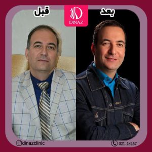 کلینیک ‏زیبایی ‏دیناز ‏خدمات ‏کاشت ‏مو ‏و ‏کاشت ‏ابرو ‏و ‏بلفاروپلاستی ‏در ‏تهران ‏سعادت ‏آباد
