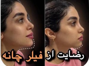 بیوتی لند تزریق چربی ژل بوتاکس لیزر موهای زائد تخلیه چربی در تهران پاسداران 10 2 1 1 1 2 1 1 1
