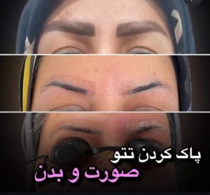 بیوتی لند تزریق چربی ژل بوتاکس لیزر موهای زائد تخلیه چربی در تهران پاسداران 11 2 1 1 1 1