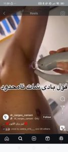 بیوتی لند تزریق چربی ژل بوتاکس لیزر موهای زائد تخلیه چربی در تهران پاسداران 12 2 1 1 1 1