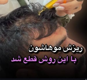 بیوتی لند تزریق چربی ژل بوتاکس لیزر موهای زائد تخلیه چربی در تهران پاسداران 13 2 1 1 1 1