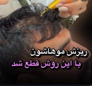 سحر بیوتی لند تزریق چربی ژل بوتاکس لیزر موهای زائد تخلیه چربی در تهران پاسداران