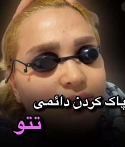 بیوتی لند تزریق چربی ژل بوتاکس لیزر موهای زائد تخلیه چربی در تهران پاسداران 5 2 1 1 1 1