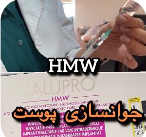 بیوتی لند تزریق چربی ژل بوتاکس لیزر موهای زائد تخلیه چربی در تهران پاسداران 7 2 1 1 1 1