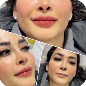 بیوتی لند تزریق چربی ژل بوتاکس لیزر موهای زائد تخلیه چربی در تهران پاسداران 8 2 1 1 1 1