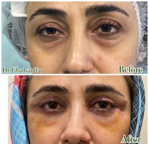 ‏قدیانی ‏فر ‏خدمات ‏ازون ‏تراپی ‏لایت ‏تراپی ‏پلاسما ‏تراپی ‏در ‏تهران ‏قیطریه 16