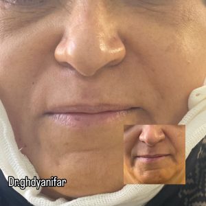 ‏قدیانی ‏فر ‏خدمات ‏ازون ‏تراپی ‏لایت ‏تراپی ‏پلاسما ‏تراپی ‏در ‏تهران ‏قیطریه 3