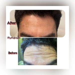 ‏قدیانی ‏فر ‏خدمات ‏ازون ‏تراپی ‏لایت ‏تراپی ‏پلاسما ‏تراپی ‏در ‏تهران ‏قیطریه 7