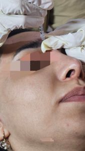 ‏ماری ‏خدمات ‏اندولیفت ‏هایفوتراپی ‏بوتاکس ‏در ‏تهران ستارخان 3