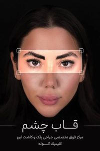 ‏گونه ‏بلفاروپلاستی ‏لیپوفیس ‏بوکال ‏فت ‏در ‏تهران ‏جردن 8