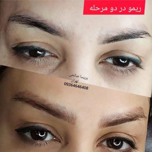 زیبایی و میکرو پریسا صالحی فیبروز میکرو لب و چشم ابرو ریمو ابرو در فلاح 16