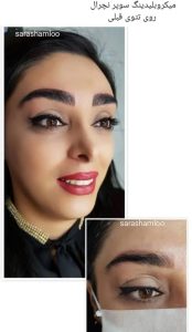 ‏سارا ‏شاملو خدمات ‏میکروبلیدینگ ‏و ‏میکروپیگمنتیشن ‏در کرج گوهر دشت 6