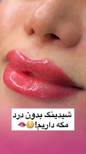 ‏جعفری ‏میکروبلیدینگ ‏شیدینگ ‏لب ‏خط ‏چشم ‏در ‏گلشهر ‏گوهردشت 5