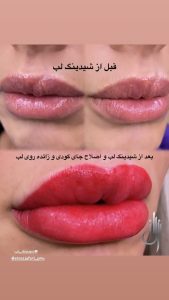 ‏جعفری ‏میکروبلیدینگ ‏شیدینگ ‏لب ‏خط ‏چشم ‏در ‏گلشهر ‏گوهردشت 7