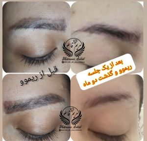 رویسا خدمات ریموو تاتو ابرو فیبروز خط چشم بن مژه در هفده شهریور تهران 10