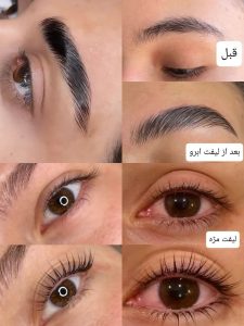 رویسا خدمات ریموو تاتو ابرو فیبروز خط چشم بن مژه در هفده شهریور تهران 17
