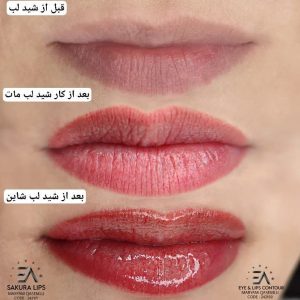 رویسا خدمات ریموو تاتو ابرو فیبروز خط چشم بن مژه در هفده شهریور تهران 7