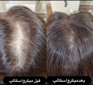 زیبایی شمیم میکروبلیدینگ تاتو خط چشم آرایش دائم در خیابان فرهنگ ساری 14