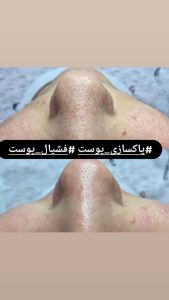 زیبایی شمیم میکروبلیدینگ تاتو خط چشم آرایش دائم در خیابان فرهنگ ساری 15