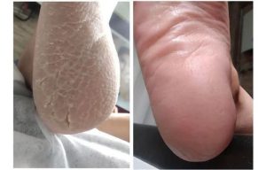 زیبایی شمیم میکروبلیدینگ تاتو خط چشم آرایش دائم در خیابان فرهنگ ساری 17