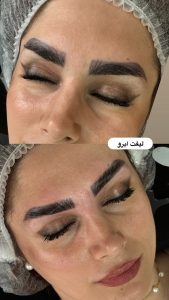 زیبایی مرکاتو فیشال پاکسازی پوست اسیدتراپی در شمس آباد هروی 17