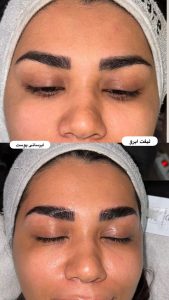 زیبایی مرکاتو فیشال پاکسازی پوست اسیدتراپی در شمس آباد هروی 18