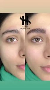 شقایق رسا میکروبلیدینگ ابرو سوپر نچرال و نچرال بروز در کرج گوهردشت 10
