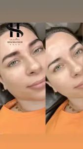 شقایق رسا میکروبلیدینگ ابرو سوپر نچرال و نچرال بروز در کرج گوهردشت 18
