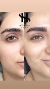شقایق رسا میکروبلیدینگ ابرو سوپر نچرال و نچرال بروز در کرج گوهردشت 19