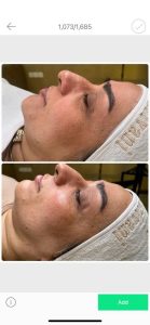 ‏زیبایی ‏عاطفه ‏مریوانی ‏مرکز ‏فیشال ‏تخصصی ‏پوست ‏در ‏اسلامشهر ‏واوان 12