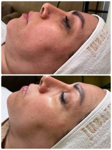 ‏زیبایی ‏عاطفه ‏مریوانی ‏مرکز ‏فیشال ‏تخصصی ‏پوست ‏در ‏اسلامشهر ‏واوان 13