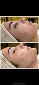 ‏زیبایی ‏عاطفه ‏مریوانی ‏مرکز ‏فیشال ‏تخصصی ‏پوست ‏در ‏اسلامشهر ‏واوان
