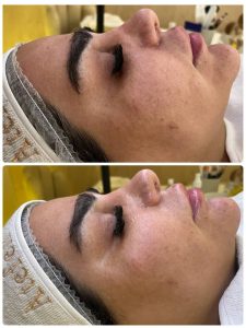 ‏زیبایی ‏عاطفه ‏مریوانی ‏مرکز ‏فیشال ‏تخصصی ‏پوست ‏در ‏اسلامشهر ‏واوان 14