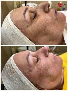 ‏زیبایی ‏عاطفه ‏مریوانی ‏مرکز ‏فیشال ‏تخصصی ‏پوست ‏در ‏اسلامشهر ‏واوان 4