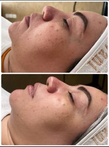 ‏زیبایی ‏عاطفه ‏مریوانی ‏مرکز ‏فیشال ‏تخصصی ‏پوست ‏در ‏اسلامشهر ‏واوان 7