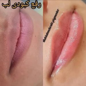 ‏زیبایی ‏مهتاب ‏محرابی ‏خدمات ‏میکروبلیدینگ ‏و ‏فیبروز ‏و ‏هاشور ‏در ‏پیروزی 4 result result