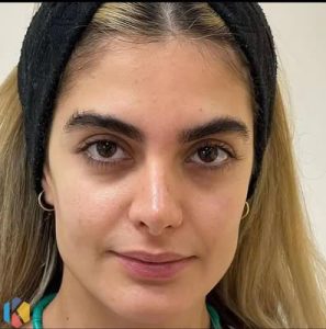 ‏زیبایی ‏نقش ‏بیتا ‏رنگ ‏لایت ‏شینیون ‏کراتین ‏مو ‏در ‏ستارخان ‏غرب ‏تهران 16
