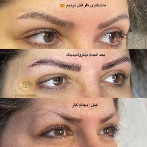 ‏شیما ‏خادمی ‏فیبروز ‏ابرو ‏و ‏تاتو ‏بدن ‏میکروبلیدینگ ‏در ‏ستارخان 5