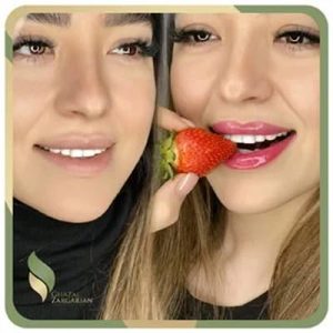 ‏غزل ‏زرگریان ‏میکروبلیدینگ ‏میکروپیگمنتیشن ‏شیدینگ ‏لب ‏در ‏سعادت ‏آباد ‏بلوار ‏دریا 3
