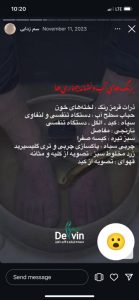 لیزر و لاغری دلوین خدمات دستگاه لاغری لیزر در تهران ازگل 14