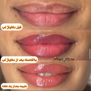 مجیدی میکروبلیدینگ هاشور ابرو شیدینگ لب در نارمک میدان هفت حوض 7