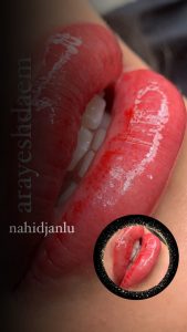 ‏جانلو ‏میکروبلیدینگ ‏بن ‏مژه ‏خط ‏چشم ‏دائم ‏در ‏ساری ‏پیام ‏نور 9