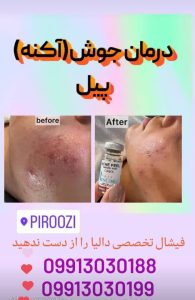 زیبایی دالیا خدمات لیزر و فیلر لب و فیشال در پیروزی
